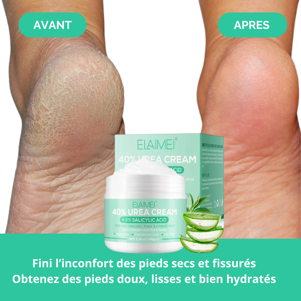 Grand Pot 150G Crème Pour Pieds à l'Urée 40% : Réparatrice et Hydratante